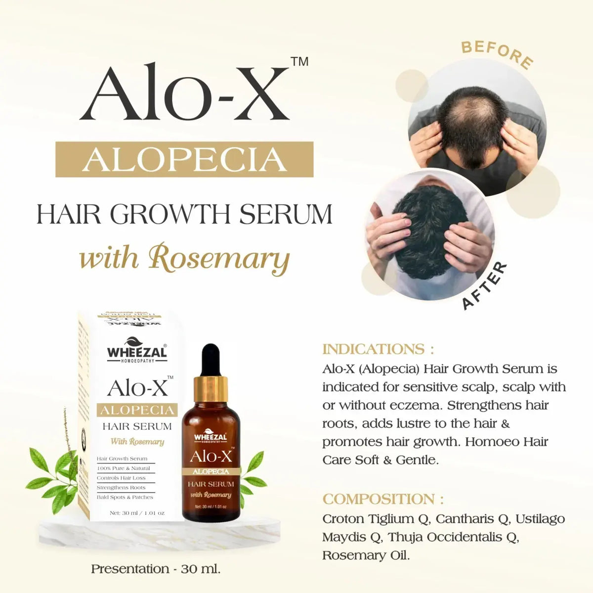 Wheezal Alo-X Alopecia Hair Serum with Rosemary (30ml, Pack of 1)